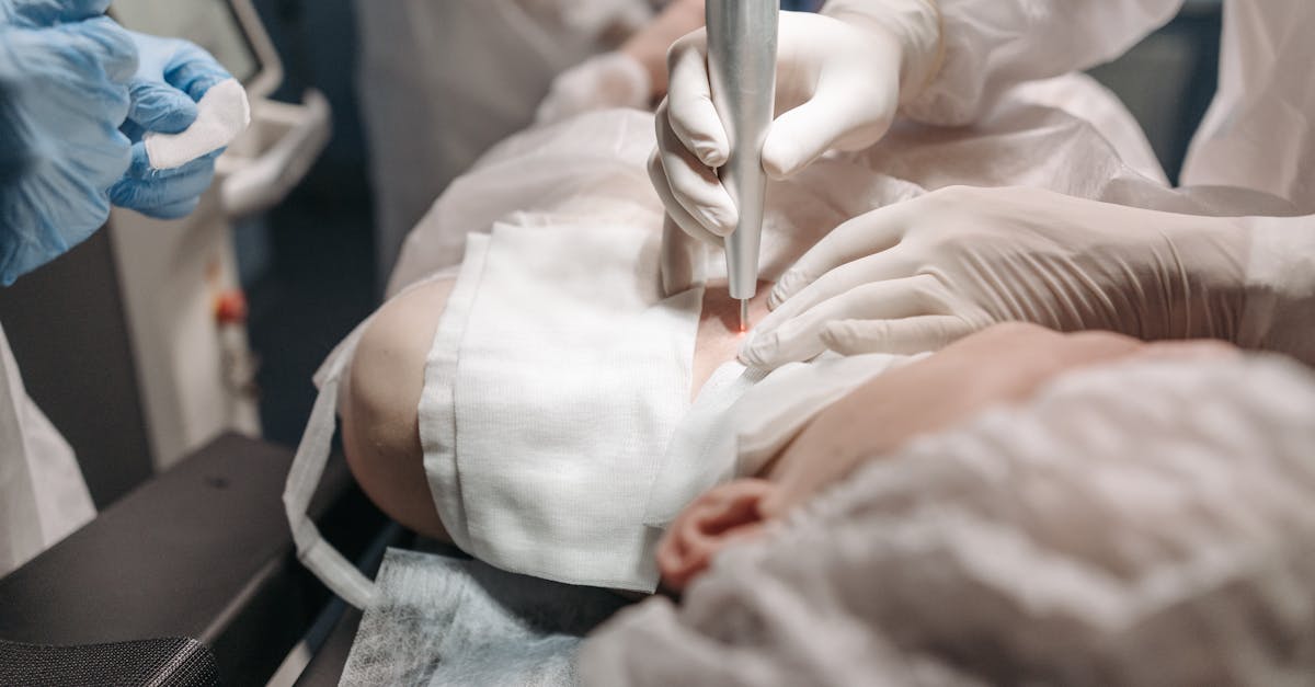 découvrez la chirurgie reconstructive, une spécialité médicale dédiée à la restauration de la forme et de la fonction du corps après des blessures, malformations congénitales ou interventions chirurgicales. apprenez-en davantage sur les techniques, les bénéfices et les processus de récupération associés à cette chirurgie.