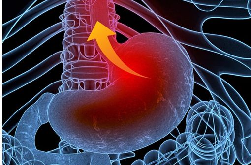 Learn about the side effects of omeprazole, a common treatment for acid reflux. Learn about possible reactions, their frequency and how to manage them for safe use of this medicine.