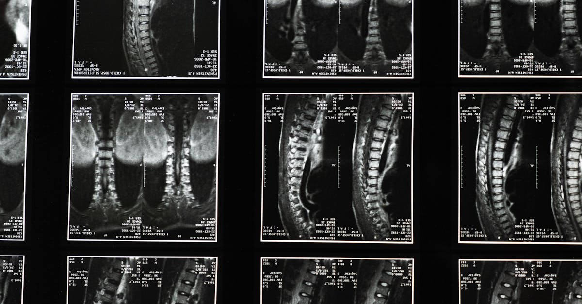 discover the world of medical imaging, an essential technology for the diagnosis and monitoring of diseases. Explore the different techniques, such as MRI, X-ray and ultrasound, which are revolutionizing healthcare by providing precise images for better patient care.