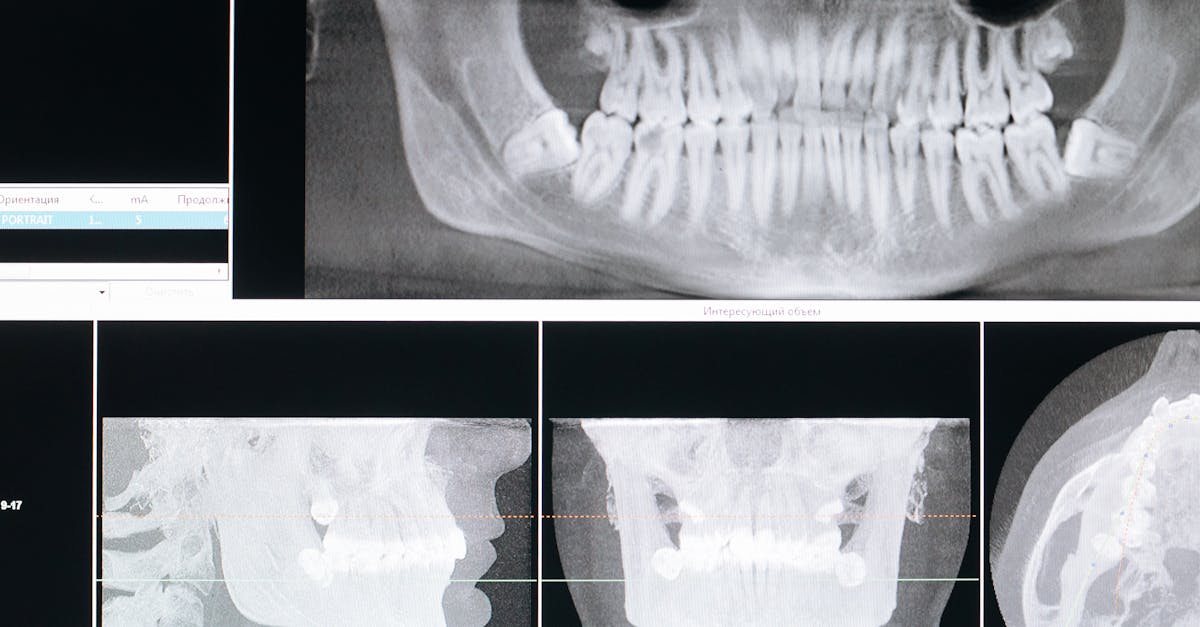 discover the importance of interventional radiology, an innovative medical specialty that uses imaging techniques to diagnose and treat diseases in a less invasive manner. learn more about its applications, benefits, and its impact on patient care.