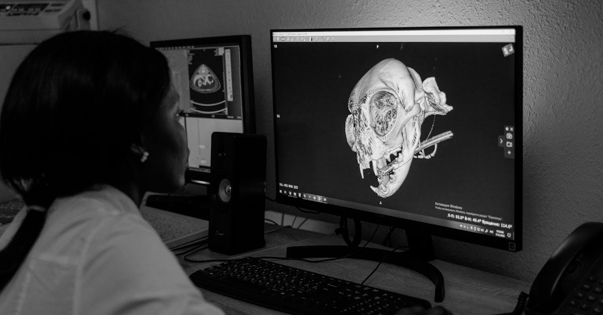 découvrez l'univers de l'imagerie médicale, une discipline essentielle qui utilise des technologies avancées pour visualiser l'intérieur du corps humain. informez-vous sur les différents types de techniques d'imagerie, leurs applications cliniques et les avancées récentes dans ce domaine crucial pour le diagnostic et le traitement des maladies.