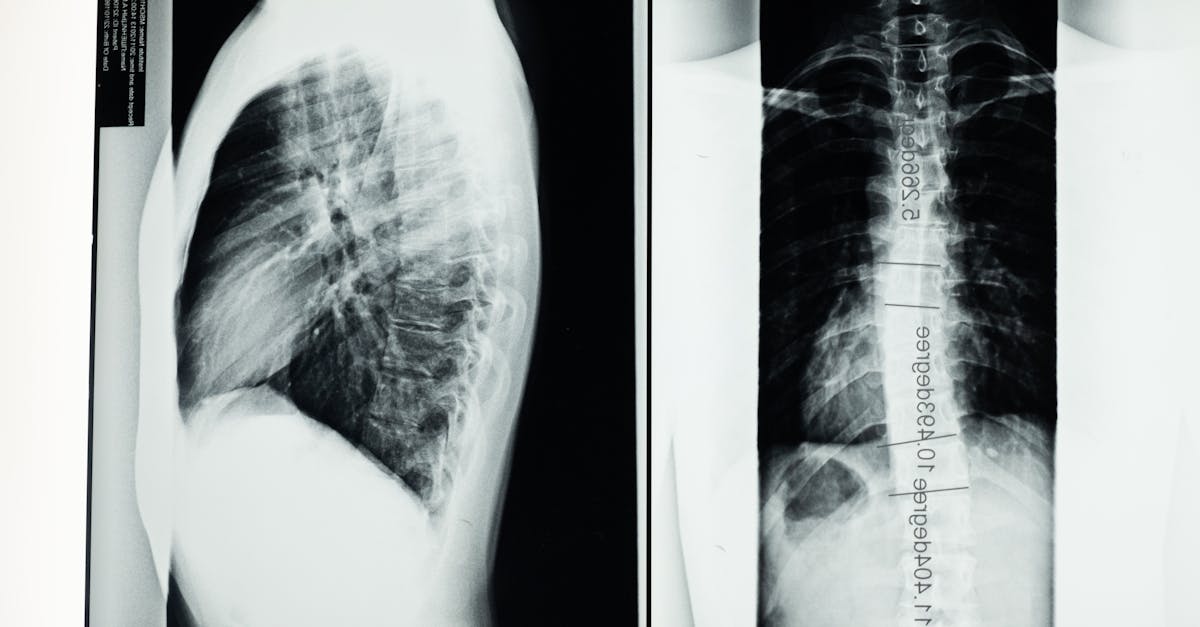 découvrez l'imagerie médicale, une technologie essentielle pour le diagnostic et le suivi des maladies. apprenez comment les techniques d'imagerie avancées, telles que l'irm, la radiographie et l'échographie, transforment les soins de santé en offrant des visualisations précises et des analyses approfondies.