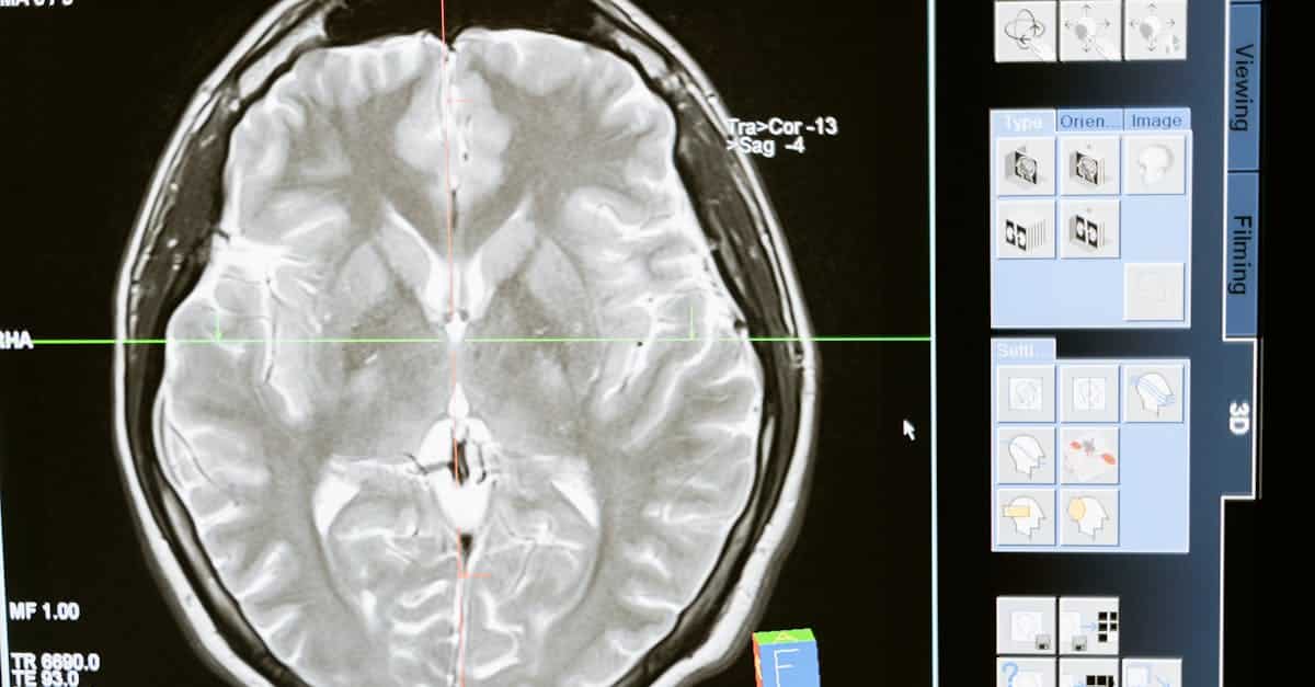 découvrez les avancées de l'imagerie médicale, une technologie essentielle pour le diagnostic et le suivi des maladies. explorez les différentes techniques, telles que l'irm, le scanner et l'échographie, qui révolutionnent les soins de santé en offrant des images précises et détaillées du corps humain.