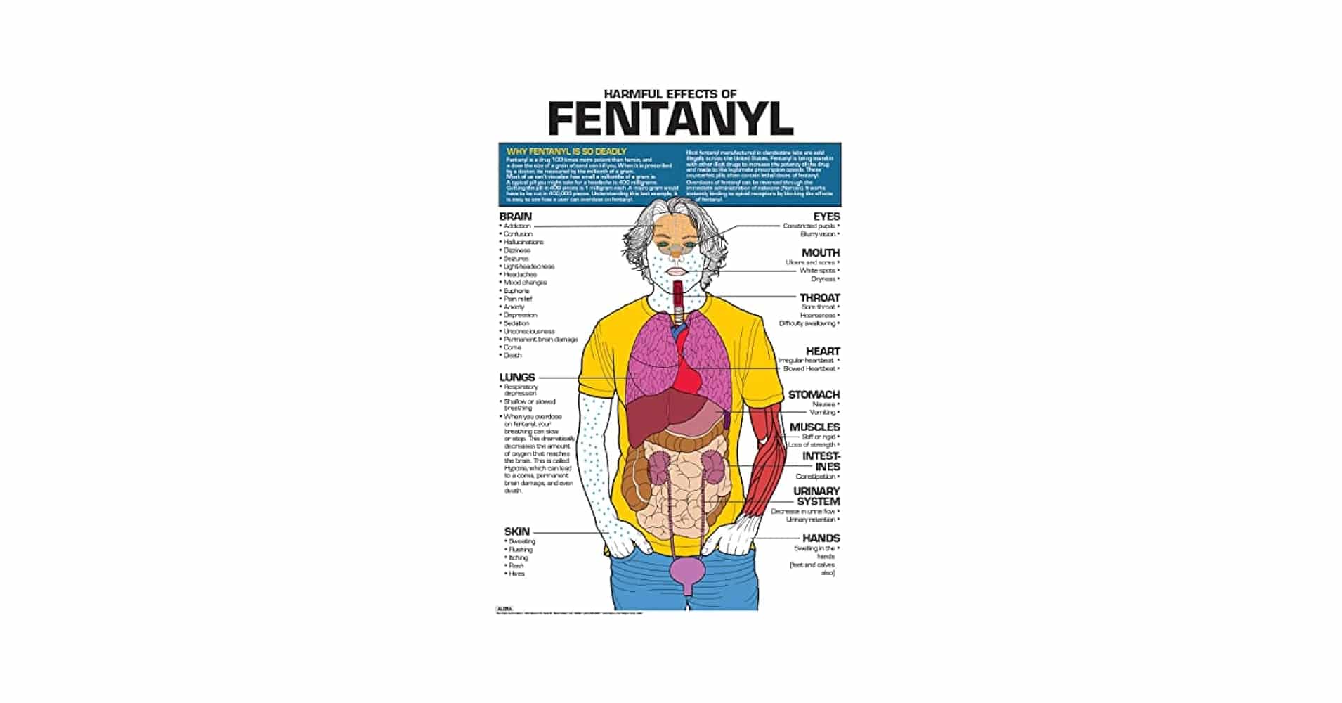découvrez les effets du fentanyl, un analgésique opioïde puissant, ses impacts sur la santé et les risques associés à sa consommation. informez-vous sur les conséquences potentielles et les symptômes liés à son usage.